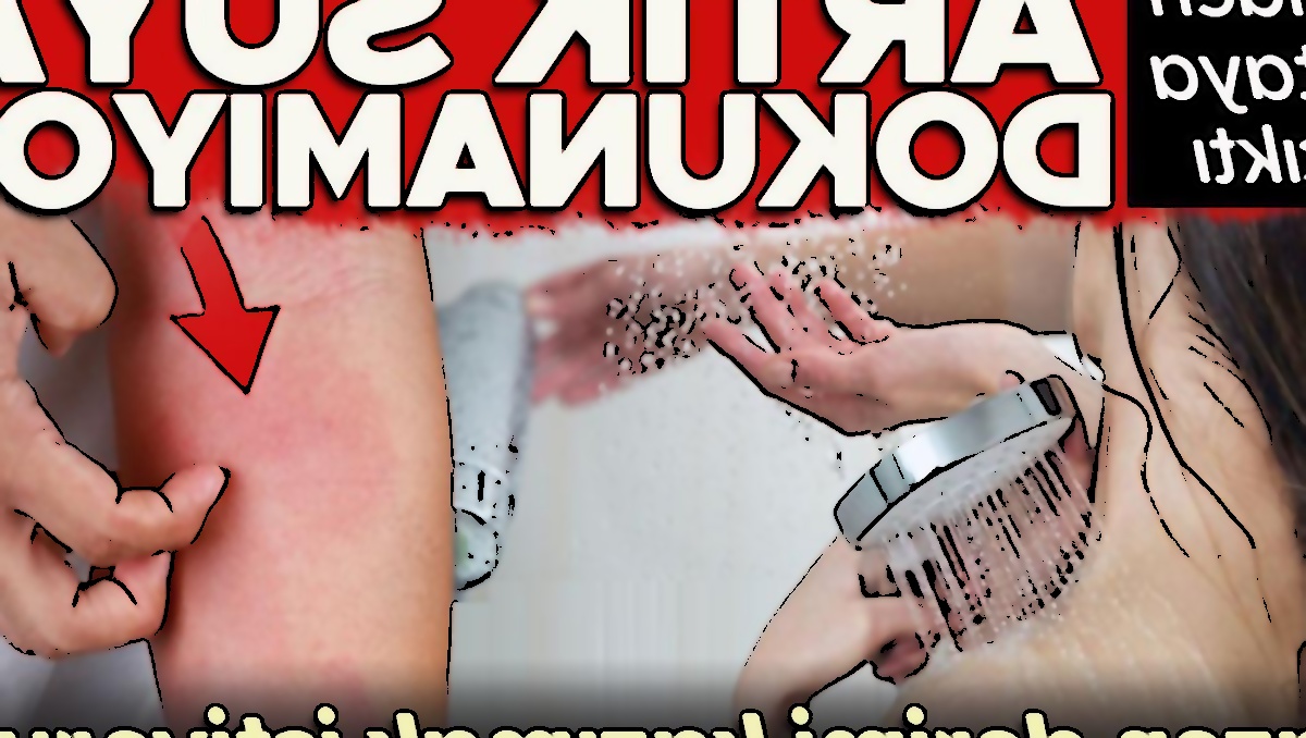 Chloe Ramsay'in Su Alerjisi: Hayatı Tehdit Eden Durum